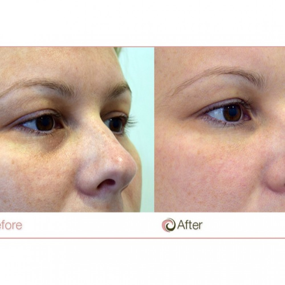 The Ordinary 5% Caffenie + EGCG Eye Serum Eliminate Best Eye Cream for Wrinkles Dark Circle Puffines